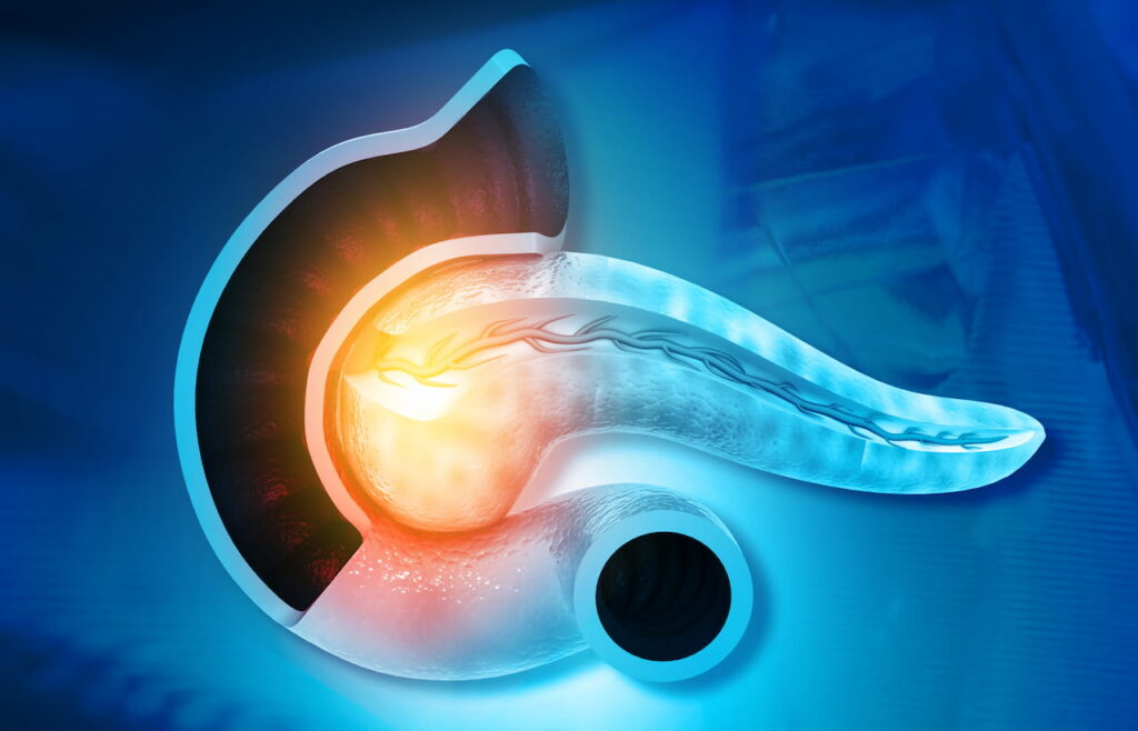 καλοήθεις όγκους ήπατος καλοήθεις όγκοι