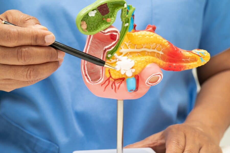 πώς θεραπεύεται η παγκρεατίτιδα