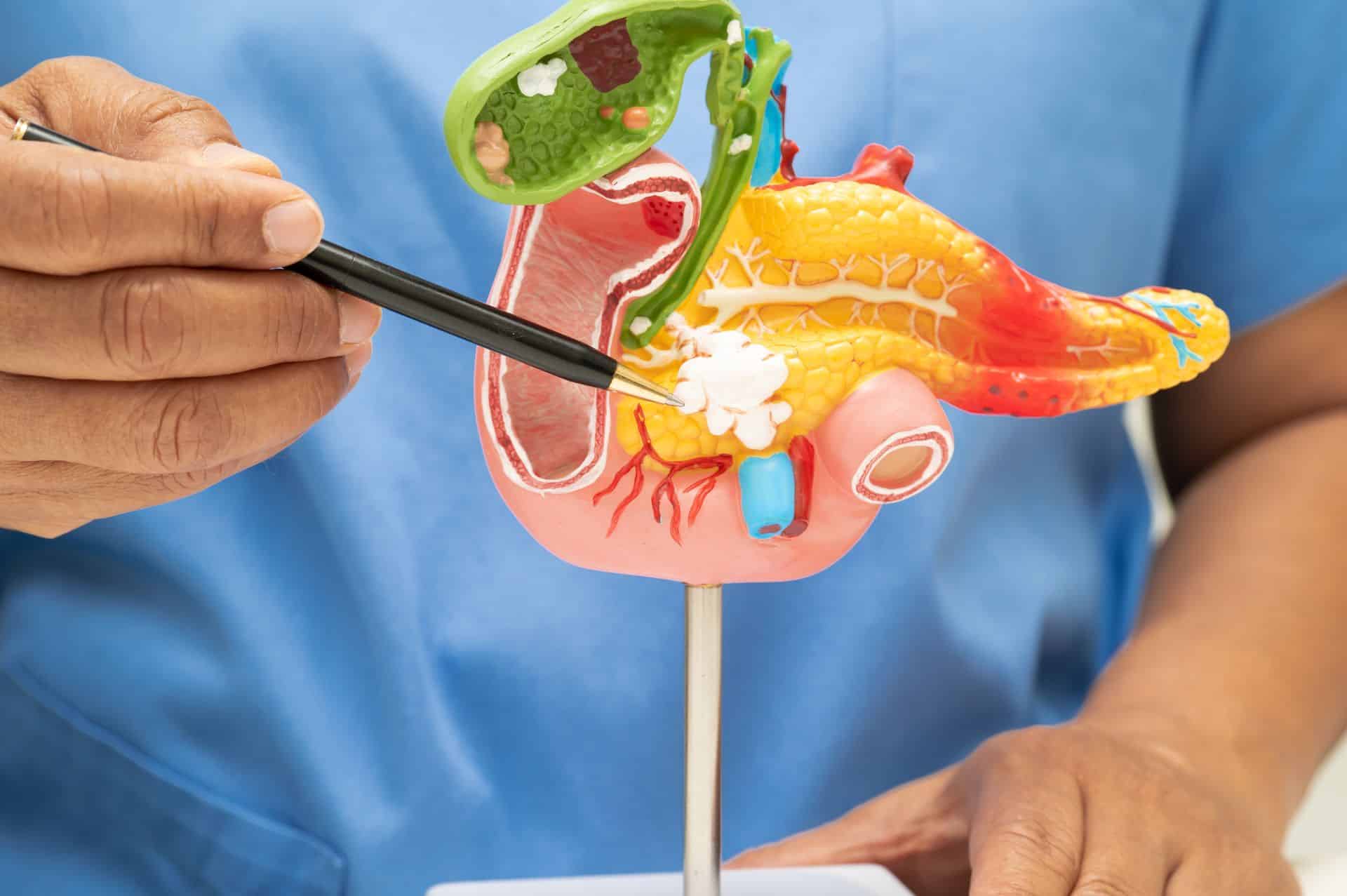 Πώς Θεραπεύεται η Παγκρεατίτιδα: Οξεία και Χρόνια