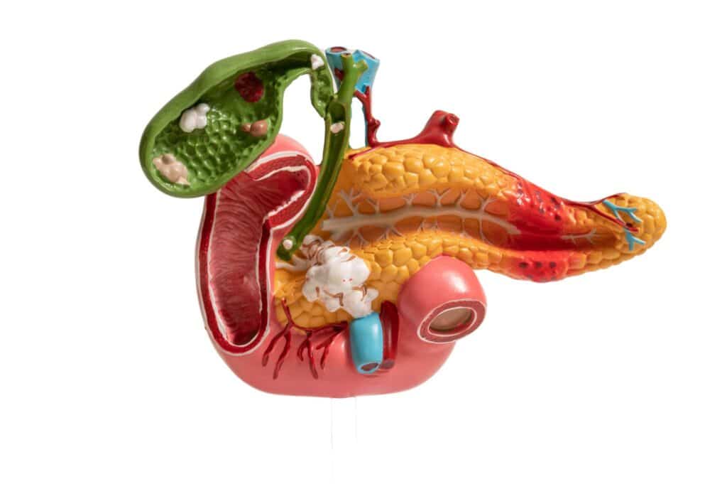 πώς θεραπεύεται η παγκρεατίτιδα